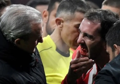 ? Auwtch! Ploegmaat van Rode Duivel mocht bijna een kunstgebitje bestellen 